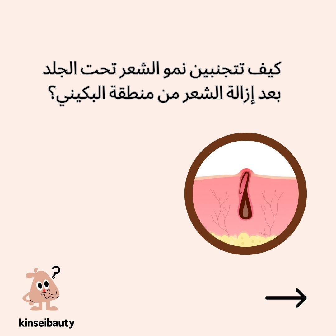 كيف تتجنبين نمو الشعر تحت الجلد بعد إزالة الشعر من منطقة البكيني؟