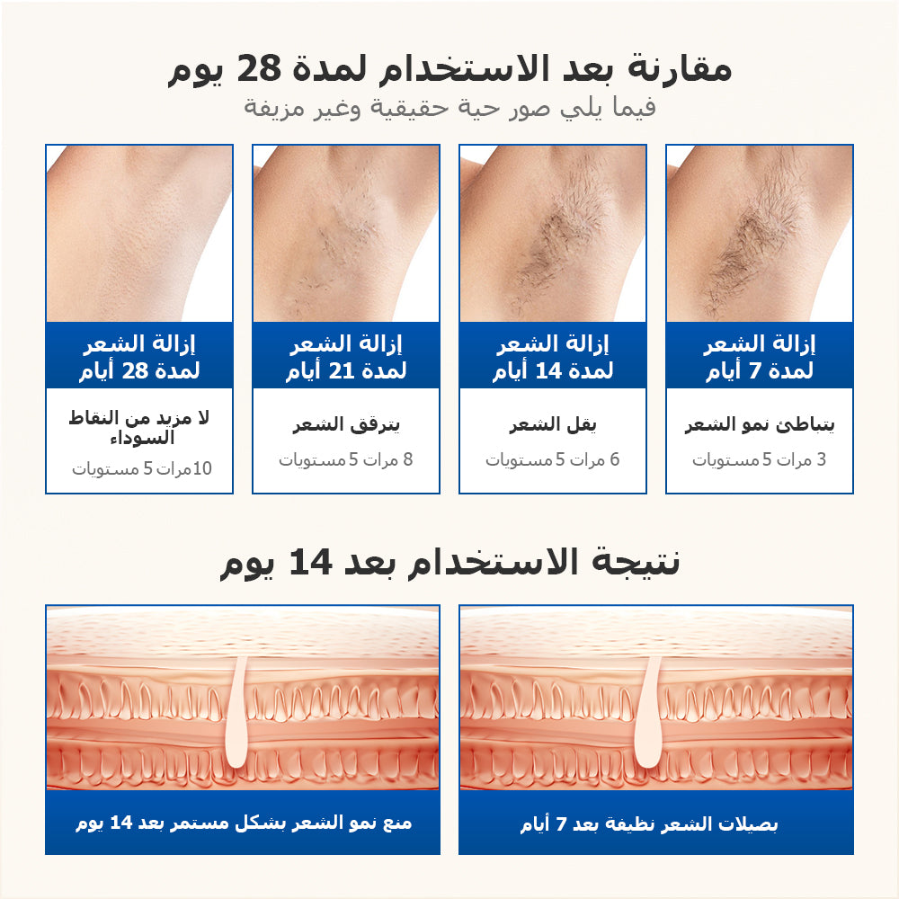 جهاز الليزر المنزلي لإزالة الشعر باللون الأزرق الياقوتي ملاي T16  (4*العدسات)