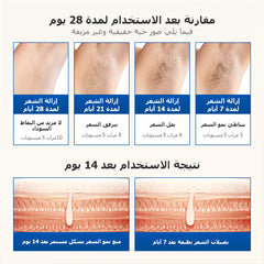 جهاز الليزر المنزلي لإزالة الشعر باللون الأزرق الياقوتي ملاي T16  (4*العدسات)